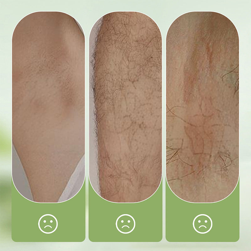 SilkEase™ — Unlock Effortless, Pain-Free Smoothness That Turns Heads