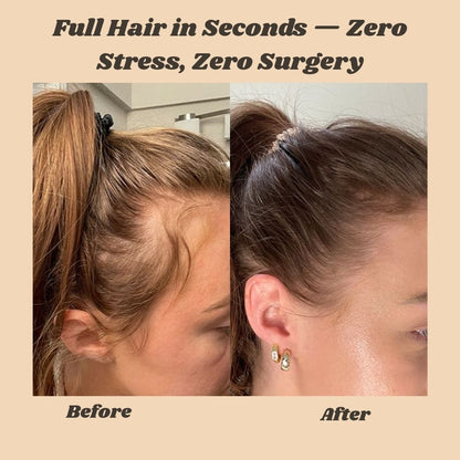 FolliBurst™ — Instantly Transform Thinning Hair into Full-Bodied Confidence