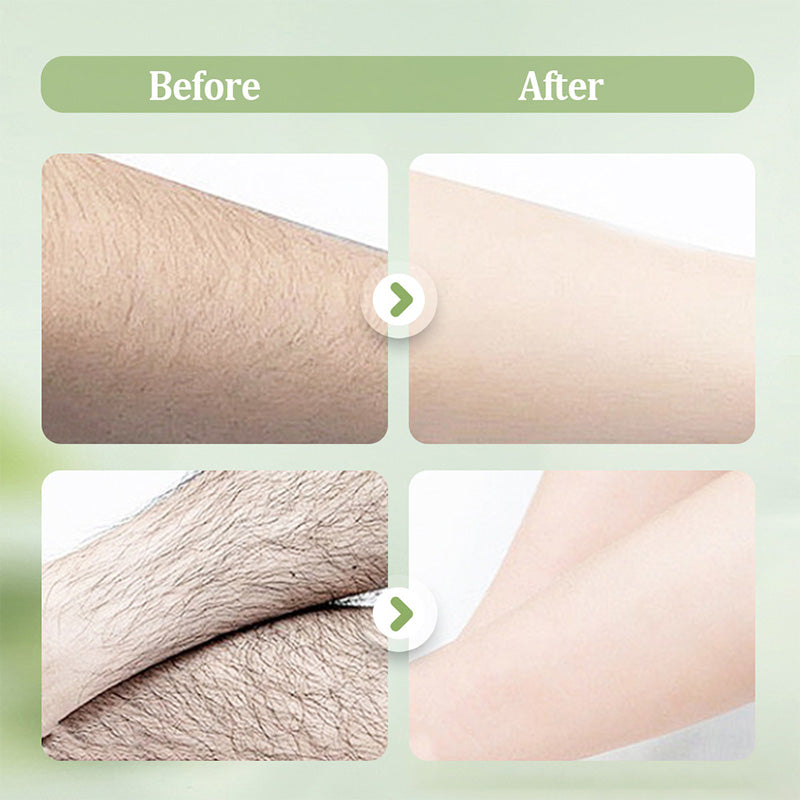SilkEase™ — Unlock Effortless, Pain-Free Smoothness That Turns Heads